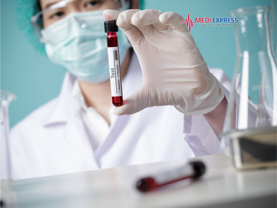 Xét nghiệm đông máu trước phẫu thuật giúp tránh những biến chứng nguy hiểm.